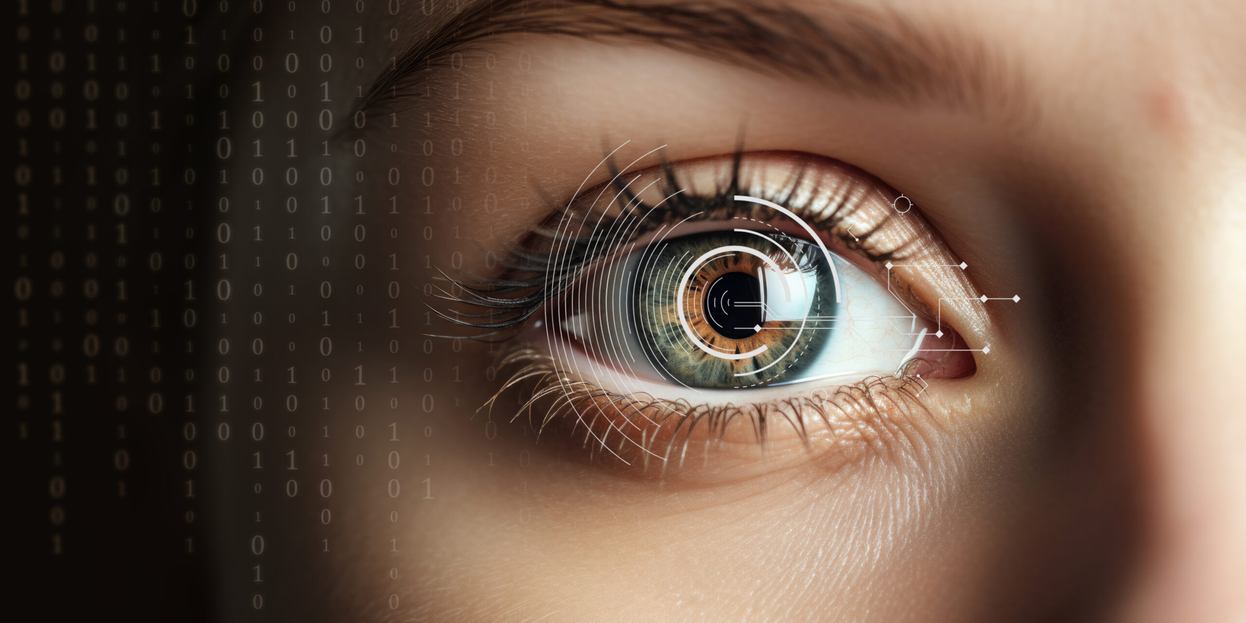 Laser Eye Surgery for Glaucoma: Close-Up woman eye with Reticle Laser Eye Surgery for Glaucoma: Close-Up woman eye with Reticle